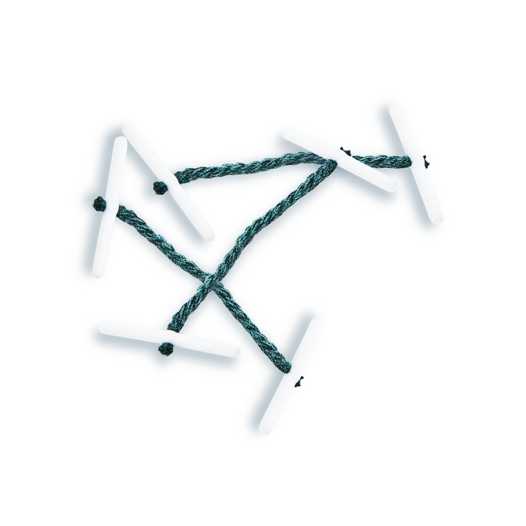 Plastic End Treasury Tags – Pack of 100